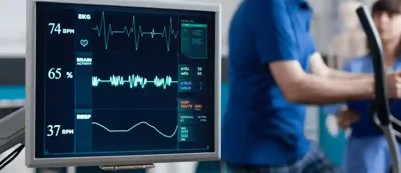 ECG Test